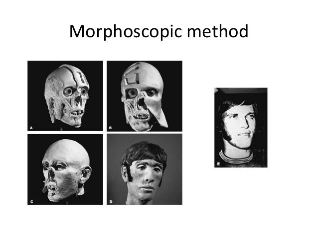 facial reconstruction in forensic science Facial reconstruction in forensic science